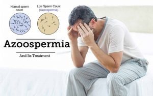 Male Infertility/ Azoospermia