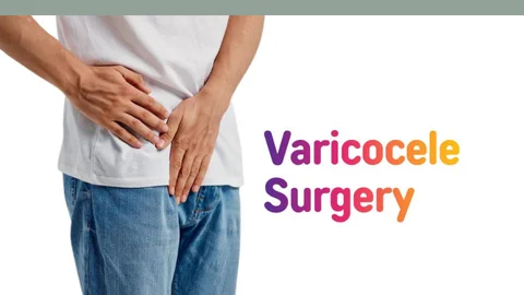 Varicocele Treatment